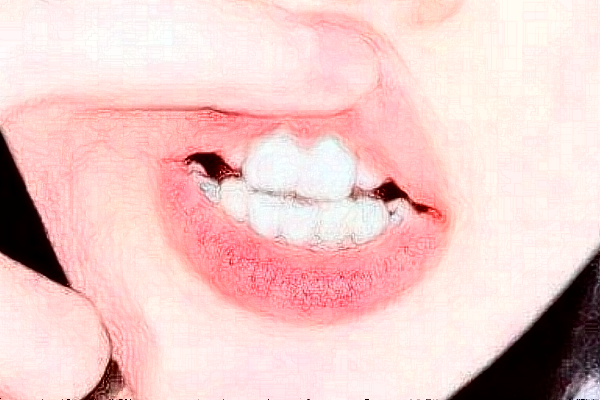 中山大學附屬口腔醫(yī)院補牙怎么樣?補牙醫(yī)生推薦名單