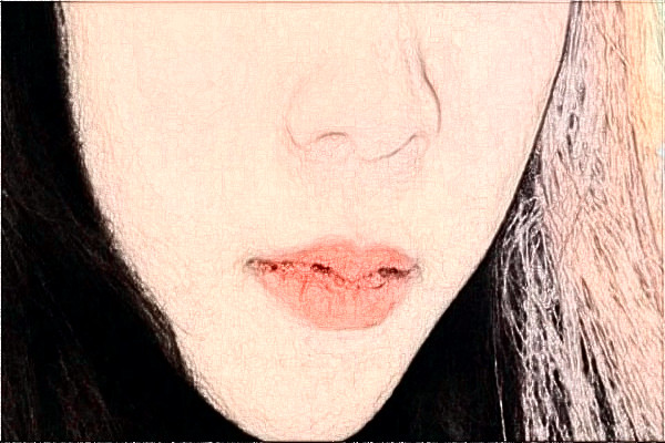 2024安徽醫(yī)科大學(xué)第一附屬醫(yī)院祛斑價格需要多少_真實案例分享