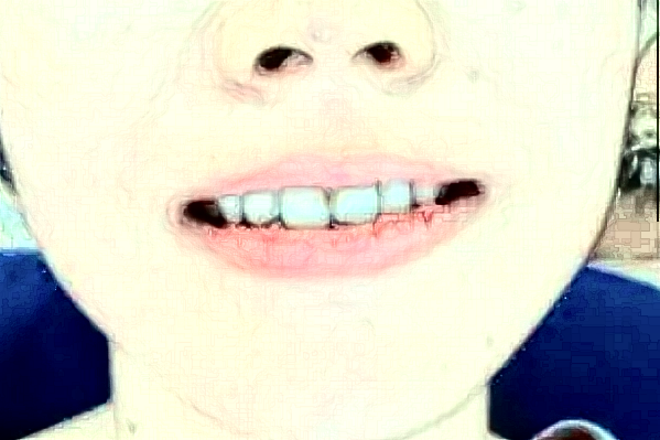 2024大慶市人民醫(yī)院口腔科正畸做的好嗎?誰做得好