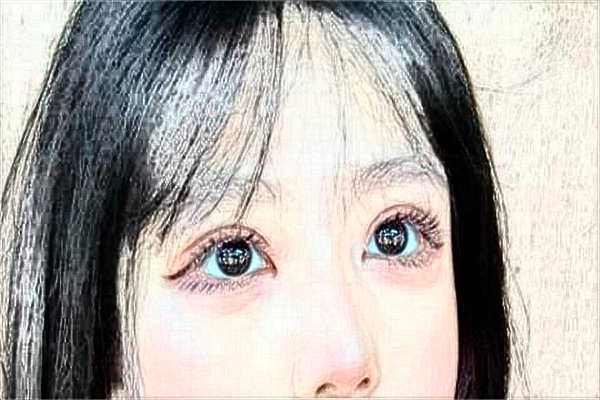 南通大學(xué)附屬醫(yī)院激光祛疤痕做的怎么樣_案例分享