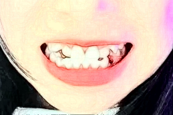 齊齊哈爾市中醫(yī)院拔牙怎么樣_誰(shuí)做得好