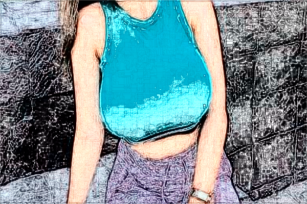 蘇北人民醫(yī)院隆胸怎么樣_案例_醫(yī)生名單