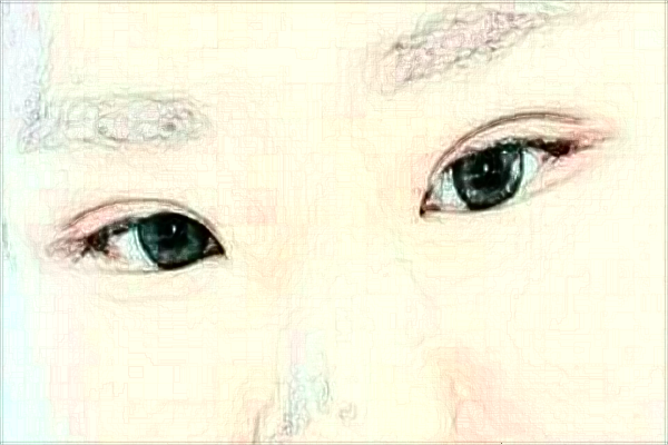 徐州醫(yī)科大學(xué)附屬醫(yī)院去眼袋做的好嗎?哪位醫(yī)生做得好