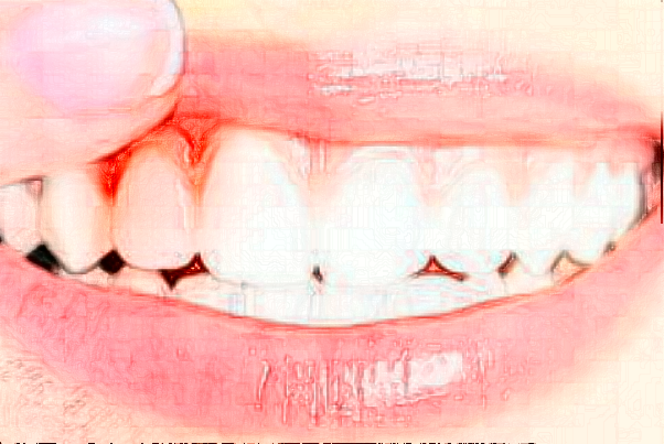 蘇州康美美容醫(yī)院牙齒修復(fù)怎么樣_誰(shuí)做得好