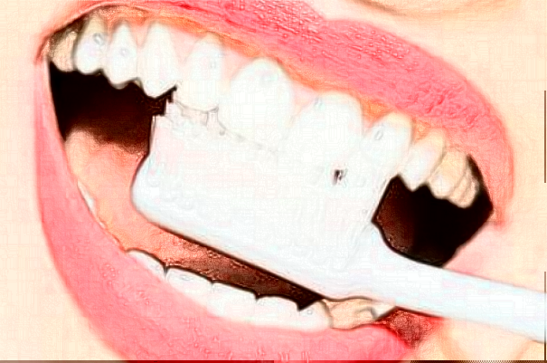 長(zhǎng)沙好大夫口腔醫(yī)院種植牙費(fèi)用多少_醫(yī)生名單