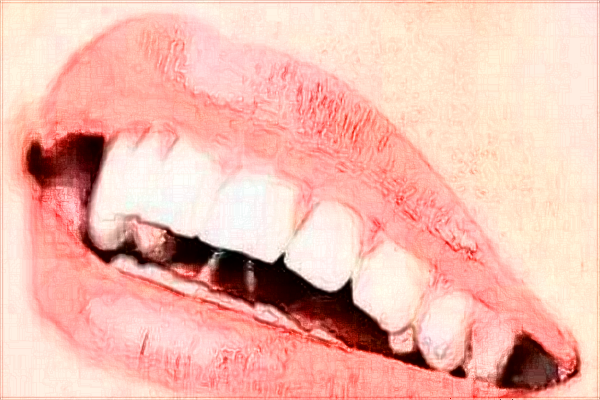 2024?？谑腥嗣襻t(yī)院補(bǔ)牙收費(fèi)標(biāo)準(zhǔn)?補(bǔ)牙材料哪種好