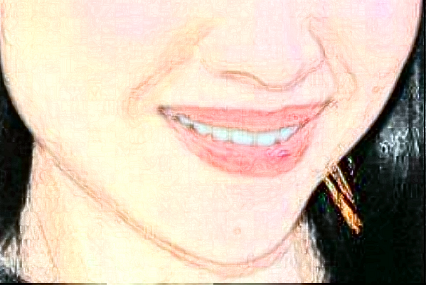 佛山市第二人民醫(yī)院去黑頭怎么樣?2024去黑頭價(jià)格