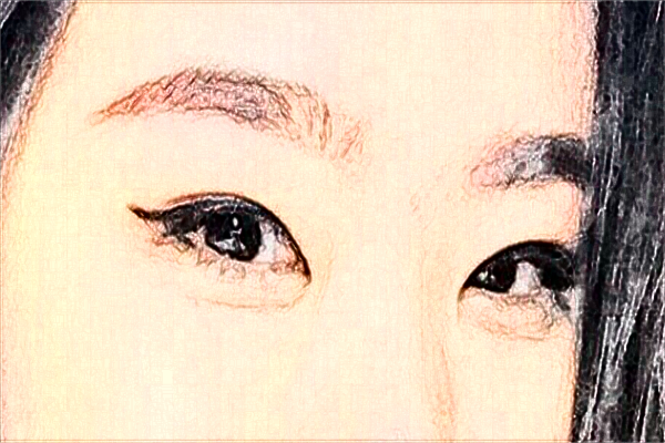 2024煙臺毓璜頂醫(yī)院整形價目表?附割雙眼皮案例