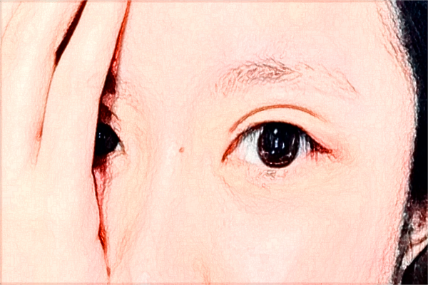 煙臺毓璜頂醫(yī)院熱瑪吉好嗎?2024熱瑪吉收費價格