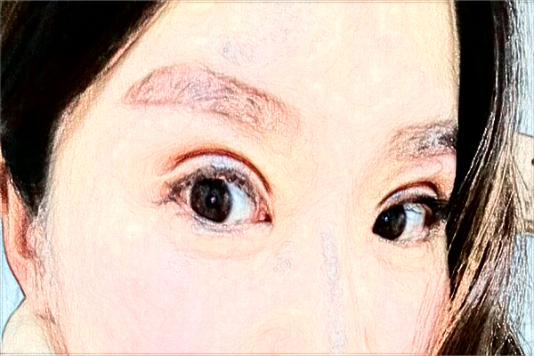 煙臺毓璜頂醫(yī)院熱瑪吉好嗎?2024熱瑪吉收費價格