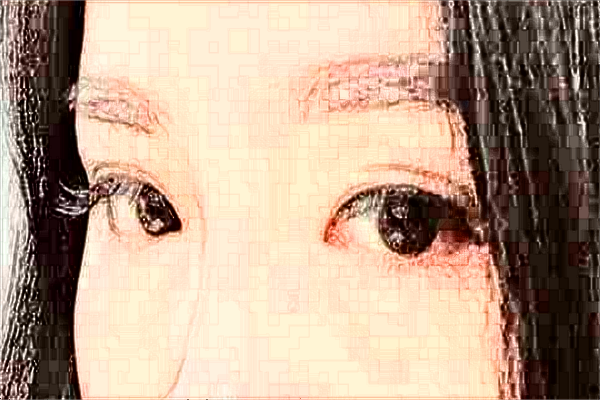 2024煙臺毓璜頂醫(yī)院飛秒激光價(jià)格?飛秒激光手術(shù)的利弊