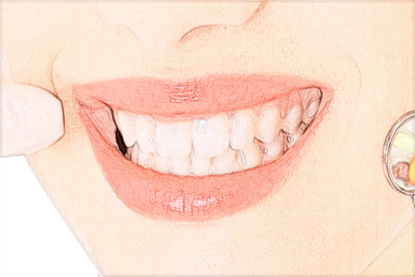 常德市第—人民醫(yī)院牙科怎么樣?牙科如何收費(fèi)