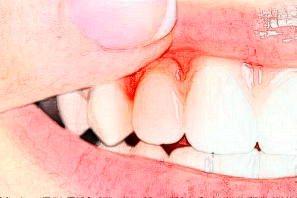 河北大學(xué)附屬醫(yī)院烤瓷牙好的大夫有誰(shuí)?醫(yī)生簡(jiǎn)介