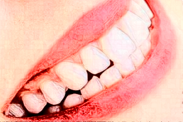 2024長(zhǎng)沙好大夫口腔醫(yī)院鑲牙多少錢?做的怎么樣