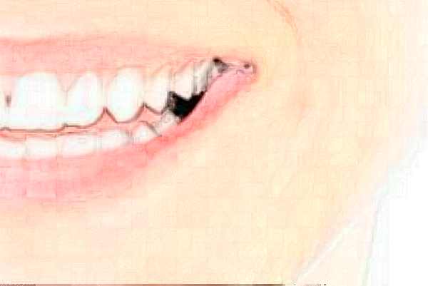 天津南開醫(yī)院牙齒矯正好的大夫有誰?醫(yī)生簡介