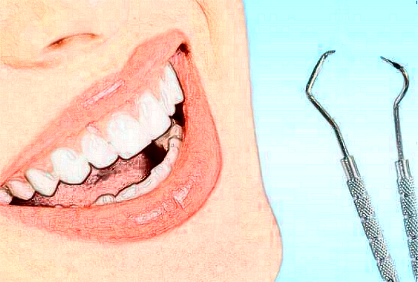 銅陵市人民醫(yī)院烤瓷牙怎么樣_案例分享