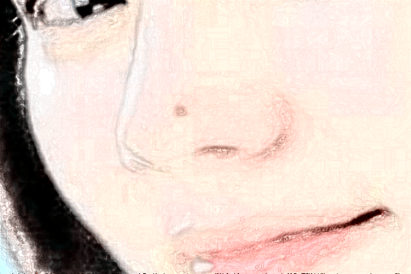 2024沈陽盛京醫(yī)院去痣好不好?體驗(yàn)日記反饋