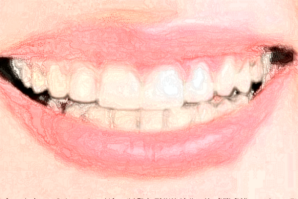 2024天津海河醫(yī)院鑲牙做的怎么樣_誰做得好