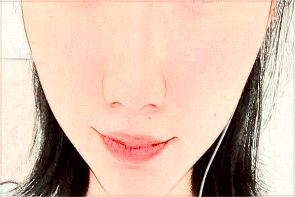 煙臺(tái)中醫(yī)院光子嫩膚好不好?2024光子嫩膚收費(fèi)價(jià)格