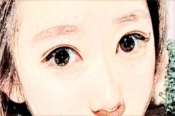 2024?？谑腥嗣襻t(yī)院飛秒手術(shù)價格?飛秒手術(shù)后注意事項