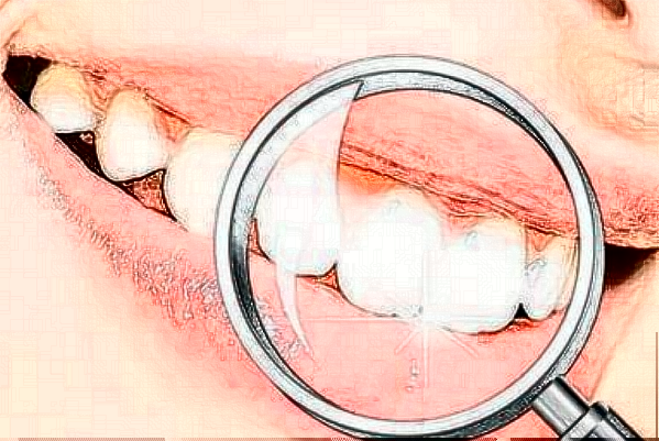 2024山東省千佛山醫(yī)院拔牙費(fèi)用?拔牙后有什么注意事項(xiàng)