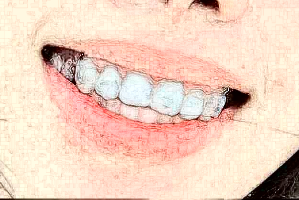 青島海慈醫(yī)院牙科大夫好嗎?牙科哪個醫(yī)生好