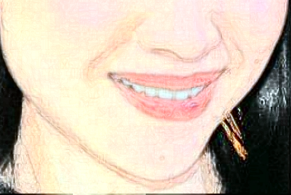 ?？谑腥嗣襻t(yī)院口腔科怎么樣?牙齒矯正好不好