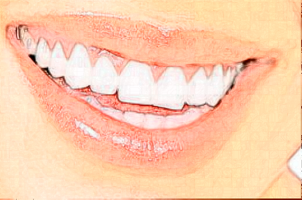 2024天津南開醫(yī)院烤瓷冠怎么樣|醫(yī)生介紹|價(jià)格收費(fèi)