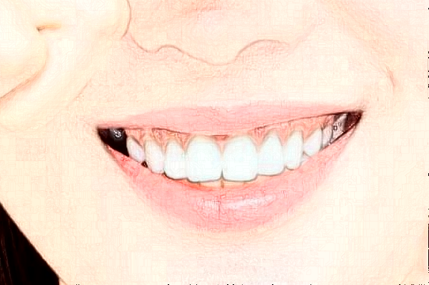 2024山西省人民醫(yī)院成人正畸價目表(價格表)_口碑怎么樣