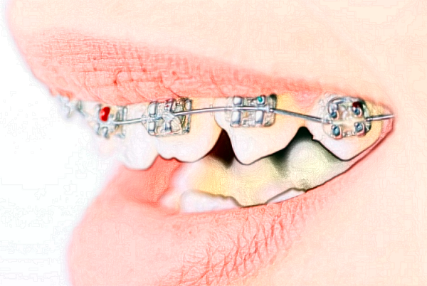 2024遼寧省人民醫(yī)院拔牙怎么樣|醫(yī)生介紹|價(jià)格收費(fèi)