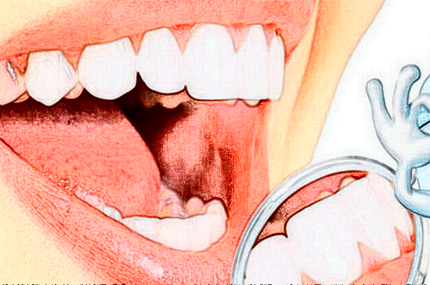 2024無錫市人民醫(yī)院烤瓷牙好嗎?附價(jià)格表+案例