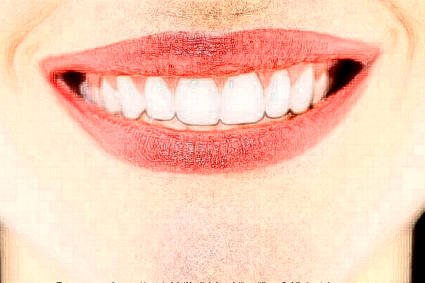 襄陽新德恩口腔門診部正畸費用多少_真實案例反饋