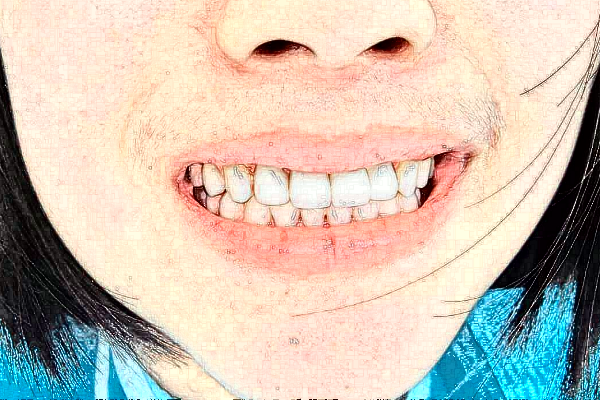 長沙好大夫口腔醫(yī)院靠譜嗎?是正規(guī)的嗎