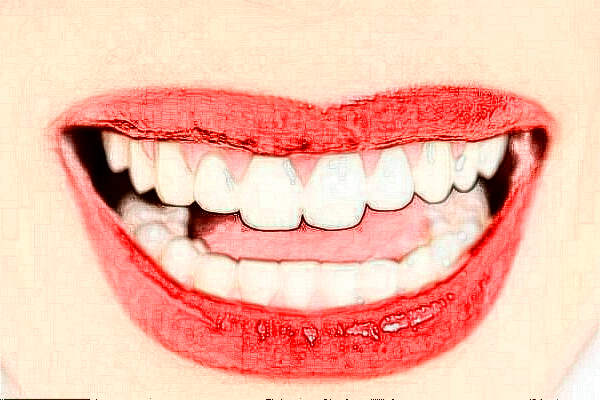 成都新橋口腔醫(yī)院種植牙醫(yī)生怎么樣?種植牙醫(yī)生收費(fèi)