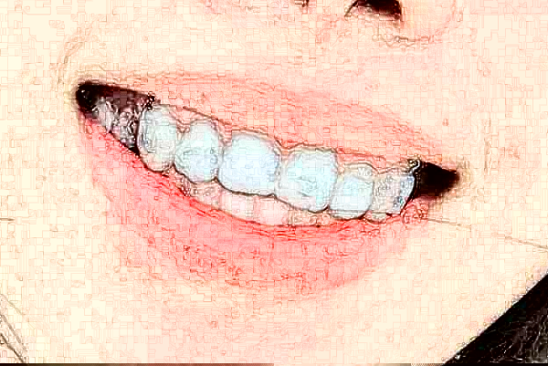 2024鄭州植得口腔醫(yī)院拔智齒多少錢?拔智齒疼嗎