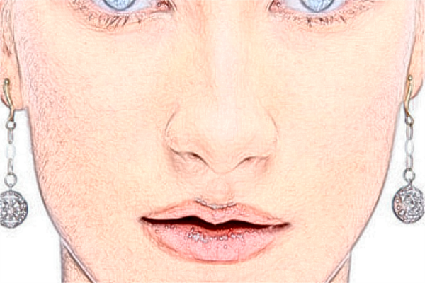 ?？谑腥嗣襻t(yī)院激光點(diǎn)痣好嗎?激光點(diǎn)痣會(huì)留疤嗎