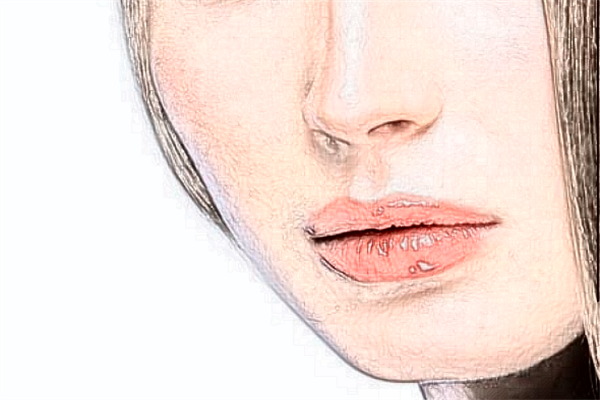 煙臺中醫(yī)院祛痘怎么樣?激光祛痘印好不好