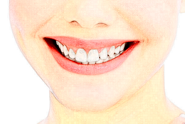 無(wú)錫市人民醫(yī)院地包天矯正價(jià)位多少?專家介紹