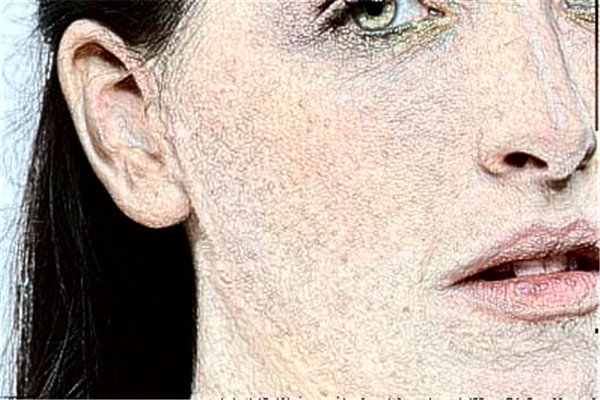 2024安徽省立醫(yī)院光子嫩膚怎么樣_應(yīng)該找誰(shuí)做