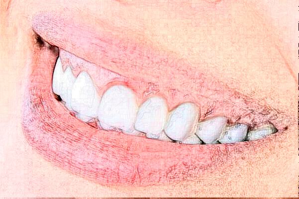 成都新橋口腔醫(yī)院正畸醫(yī)生好嗎?2024正畸牙齒的費(fèi)用