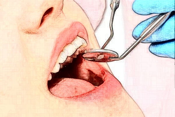 山西省人民醫(yī)院錯頜畸形矯正費(fèi)用多少?整形日記全過程