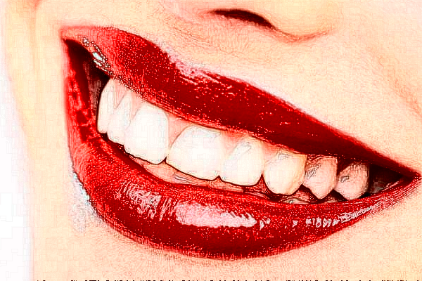 2024天津南開醫(yī)院牙齒美白怎么樣_整形日記分享