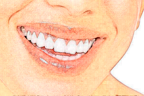 杭州植得口腔門診部鑲牙怎么樣?醫(yī)生介紹_案例分享