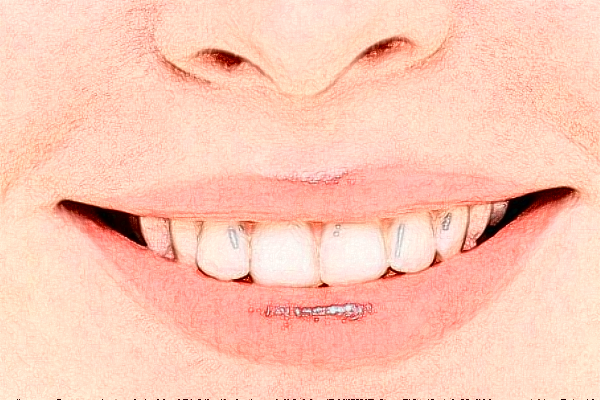 鄭州植得口腔醫(yī)院正畸醫(yī)生好不好?2024正畸醫(yī)生收費價格