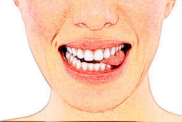 無錫市人民醫(yī)院全瓷牙做的好嗎_醫(yī)生推薦