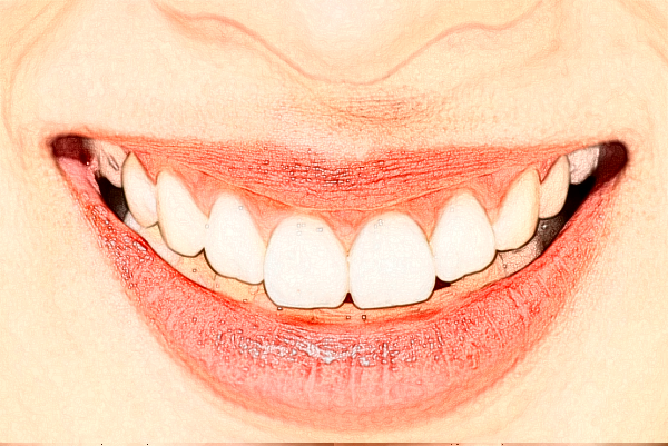 2024遼寧省人民醫(yī)院瓷貼面價目表全新發(fā)布!案例反饋