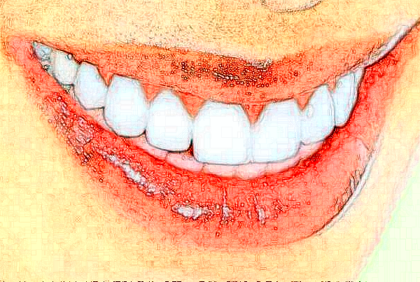 遼寧省人民醫(yī)院根管費(fèi)用多少?整形日記全過(guò)程