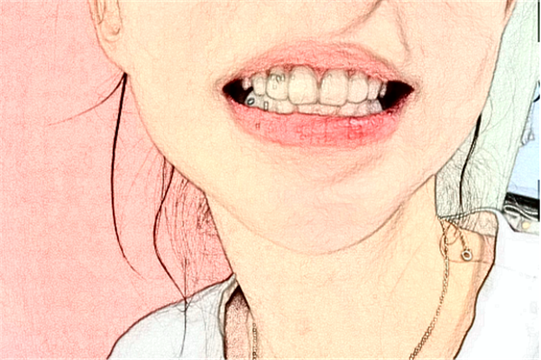 北京牙管家口腔診所補牙怎么樣|醫(yī)生介紹|價格收費