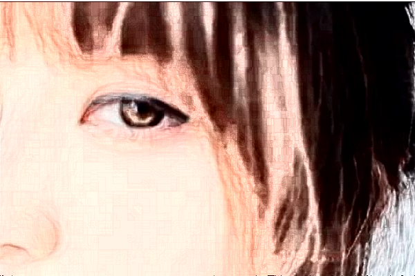 銅陵市人民醫(yī)院全飛秒怎么樣_醫(yī)生案例_評(píng)價(jià)