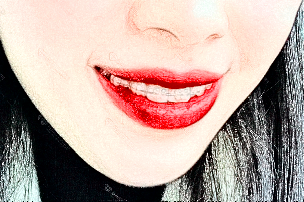 重慶世紀美奧口腔醫(yī)院醫(yī)生有哪些?附整牙案例